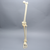 Leg with Plateau Fracture, Full Length Leg with Plateau Fracture, Full Length