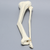 Tibia and Fibula with 30 Degree Valgus Fracture Tibia and Fibula with 30 Degree Valgus Fracture