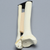 Ankle with Lateral Malleolar Fracture Ankle with Lateral Malleolar Fracture