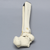 Ankle with Supination-Adduction Fracture Ankle with Supination-Adduction Fracture