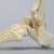 Foot and Ankle with Cavus Deformity Foot and Ankle with Cavus Deformity