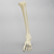 Foot and Ankle with Multiple Deformities Foot and Ankle with Multiple Deformities