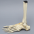 Foot and Ankle with Lisfranc Fracture Foot and Ankle with Lisfranc Fracture