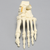 Foot includes a two-part fracture of the talus reattached with latex bands. Foot includes a two-part fracture of the talus reattached with latex bands.