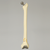 Femur with Distal Fracture and Implants Femur with Distal Fracture and Implants
