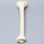 Tibia with Condylar Fracture and Fragment Tibia with Condylar Fracture and Fragment
