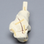 Calcaneus with Five-Part Fracture, Foam Cortical, Left Calcaneus with Five-Part Fracture, Foam Cortical, Left