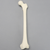Femur, 9.5 mm Canal, Foam Cortical, Left, Small Femur, 9.5 mm Canal, Foam Cortical, Left, Small