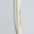 Tibia with Segmental Fracture, Solid Foam, Left, Medium