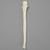 Ulna, 5mm Canal, Foam Cortical Shell, Right Ulna, 5mm Canal, Foam Cortical Shell, Right