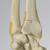 Hand and Wrist with Three-Part Fracture, Foam Cortical Hand and Wrist with Three-Part Fracture, Foam Cortical