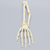 Hand and Wrist with Oblique and Colles' Fractures, Solid Foam