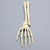 Hand and Wrist with Colles' Fracture, Solid Foam Hand and Wrist with Colles' Fracture, Solid Foam