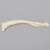 Clavicle with Butterfly Fracture, Solid Foam