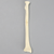 Radius with Oblique Fracture, Solid Foam Radius with Oblique Fracture, Solid Foam