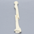 Radius with Short Oblique Fracture, 6.4mm Canal, Solid Foam Radius with Short Oblique Fracture, 6.4mm Canal, Solid Foam
