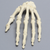 Hand with Scaphoid Fracture, Solid Foam Hand with Scaphoid Fracture, Solid Foam