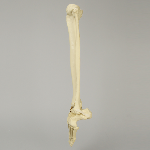 Foot and Ankle with Clubfoot and Equinus Deformities