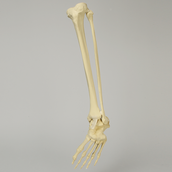 Foot and Ankle with Clubfoot and Equinus Deformities