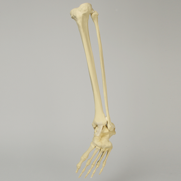 Foot and Ankle with Clubfoot and Equinus Deformities