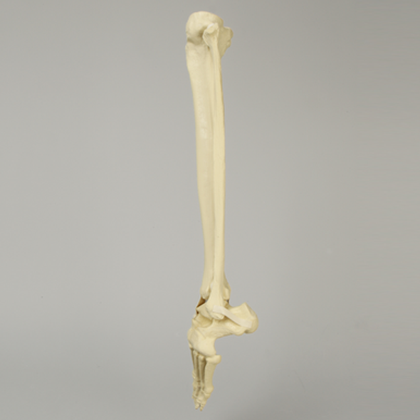 Foot and Ankle with Clubfoot and Equinus Deformities