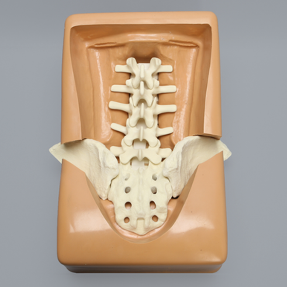 Lumbar Holder with Iliac Wing Cutouts