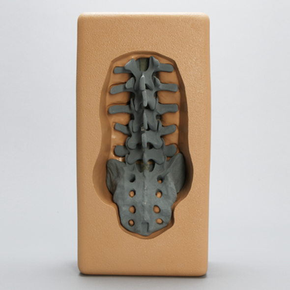 Lumbar Vertebrae, Radiopaque with Posterior Approach Holder