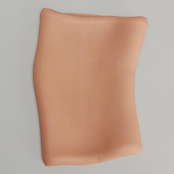 Knee Skin Replacement, Arthroscopy