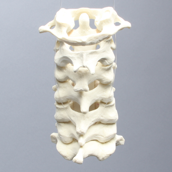 Spine, Cervical, Posterior Ligament, Solid Foam