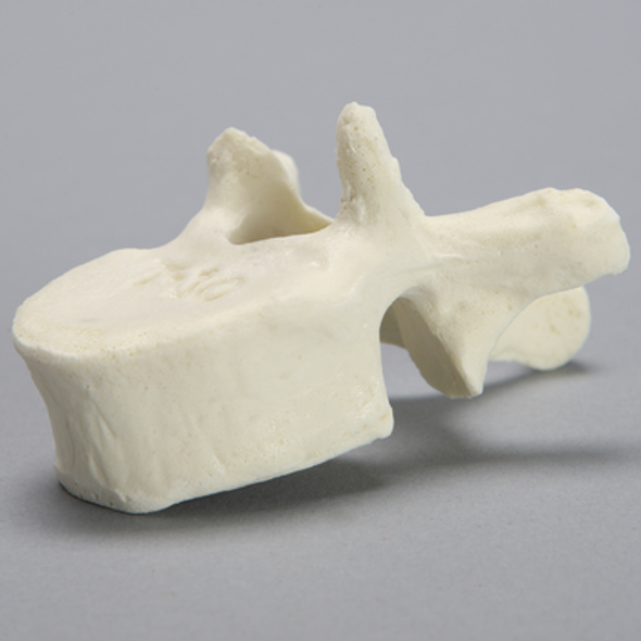 Vertebra, T10, Foam Cortical