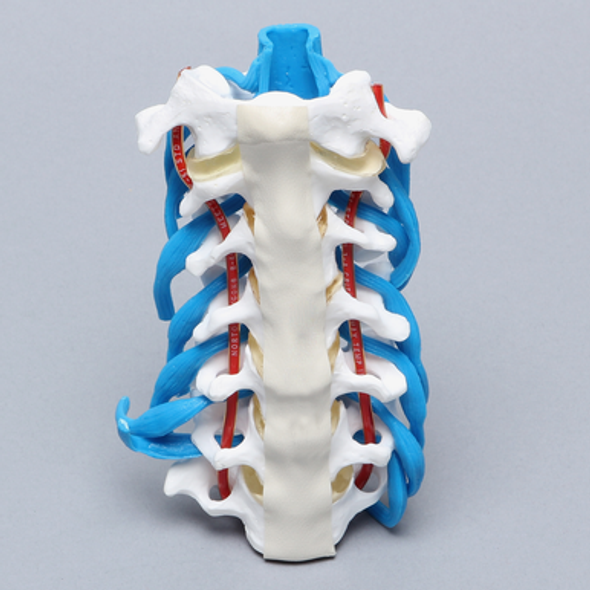 Cervical Spine with Dura and Nerve Roots