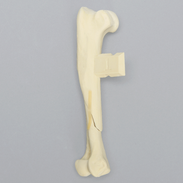 Canine Humerus with Oblique Fracture, Foam Cortical