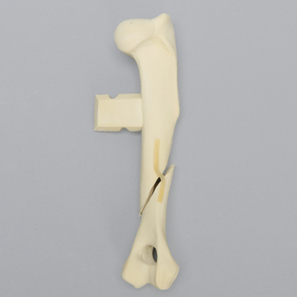 Canine Humerus with Oblique Fracture, Foam Cortical