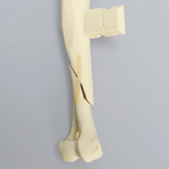 Canine Humerus with Oblique Fracture, Foam Cortical