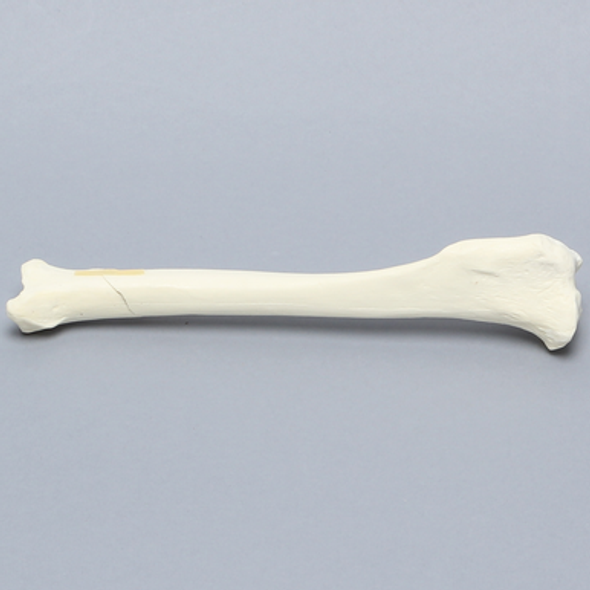Canine Tibia with Distal Oblique Fracture, Foam Cortical