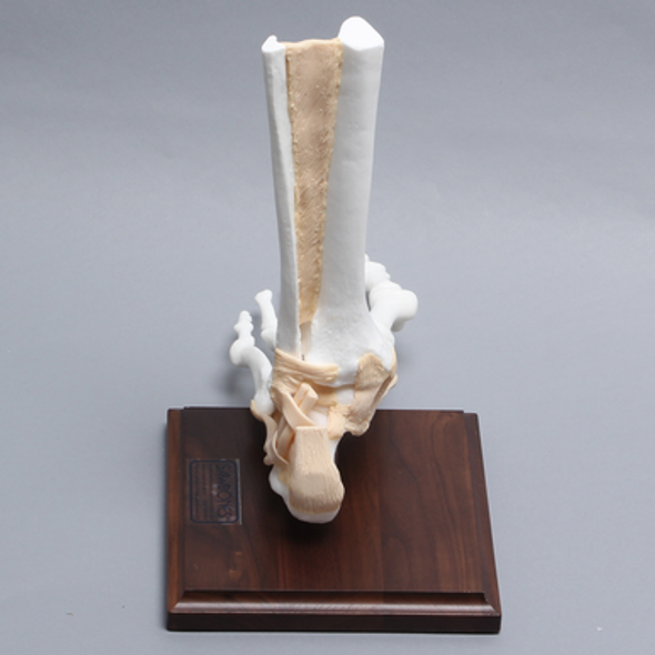 Foot and Ankle with Bunion, Hammertoes, and Heel Spur with Stand