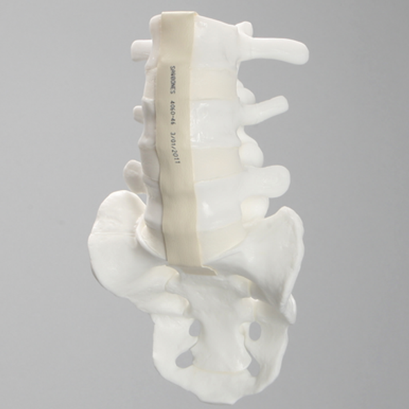 Lumbar Vertebrae, L3-Sacrum, With White Discs