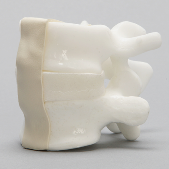 Lumbar Vertebrae, L4-L5, With White Disc