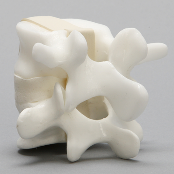 Lumbar Vertebrae, L4-L5, With White Disc