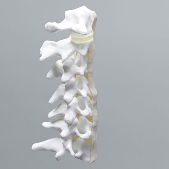 Cervical Spine with Anterior and Posterior Ligaments and Clear Discs