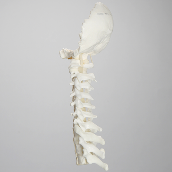 Spine, Occipital-T3 with White Foam Discs