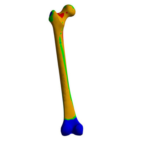 Osteoporotic Composite Femur, Finite Element Model of #3503