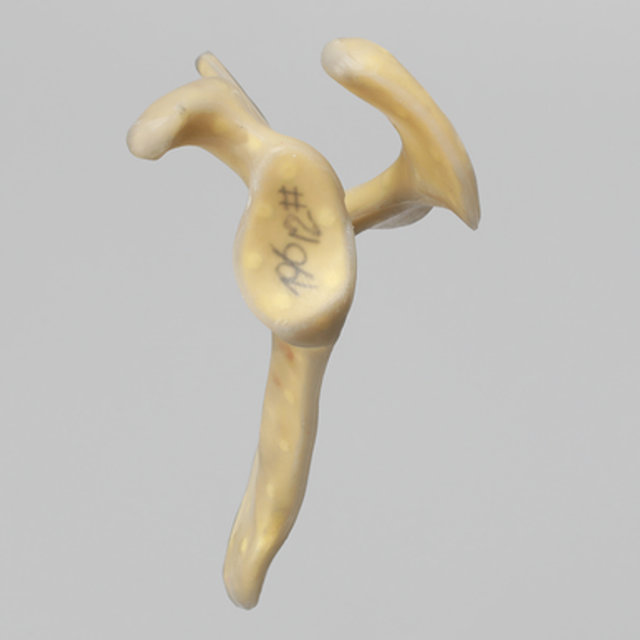 Scapula, absolute™ 4th Gen., 17 PCF Solid Foam Core, Large