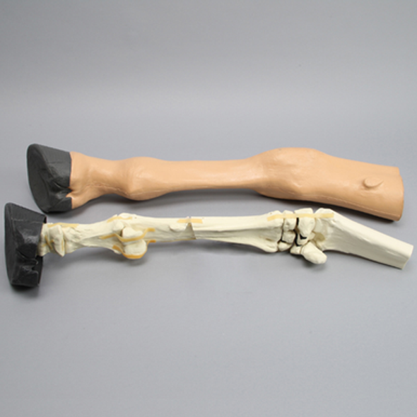 Equine Encased Distal Thoracic Limb with Metacarpal and Phalanx Fractures
