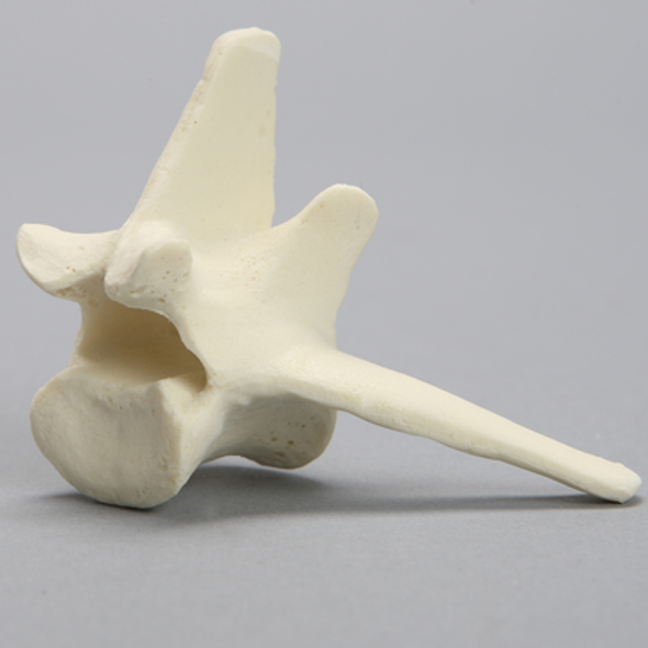 Canine Vertebra, L6, Solid Foam