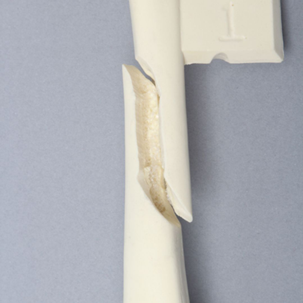 Canine Femur with Long Oblique Fracture