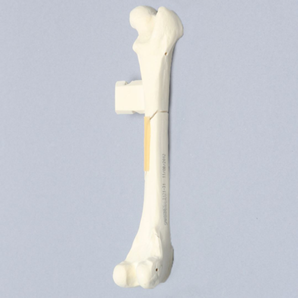 Canine Femur with Long Oblique Fracture