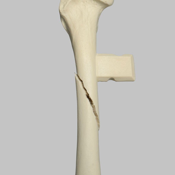Canine Femur with Long Oblique Fracture