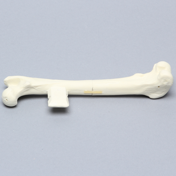 Canine Femur with Midshaft Transverse Fracture and Vise Attachment
