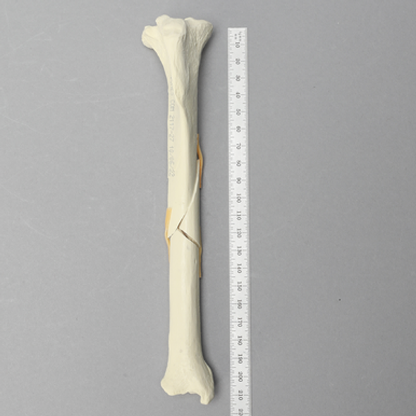 Canine Femur with Short Oblique Fracture